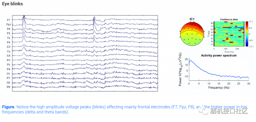 eeg伪影类型详解和过滤工具的汇总(一)_脑机接口社区的博客-csdn博客