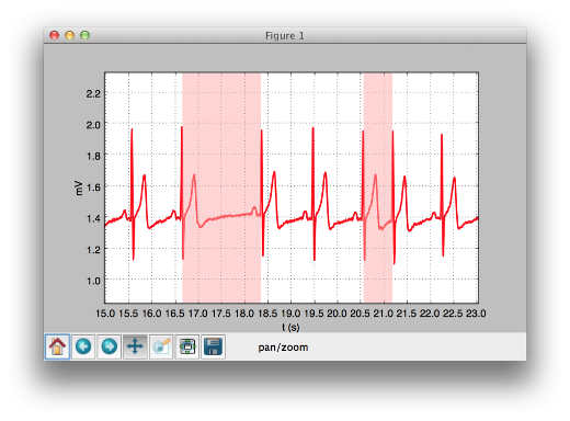 BITalino ECG results showing heart rate