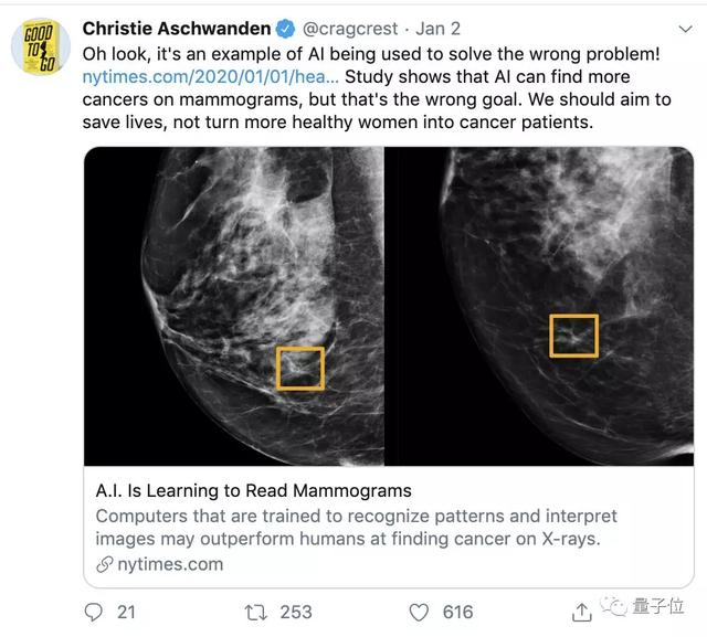 谷歌AI乳腺癌检测超过人类？美国知名记者：让糟糕的医疗更糟罢了