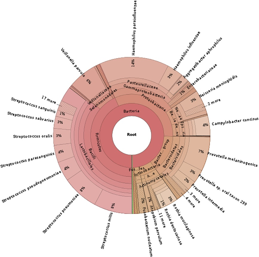 Kraken：使用精确比对的超快速宏基因组序列分类软件_ultrafast Metagenomic Sequence ...