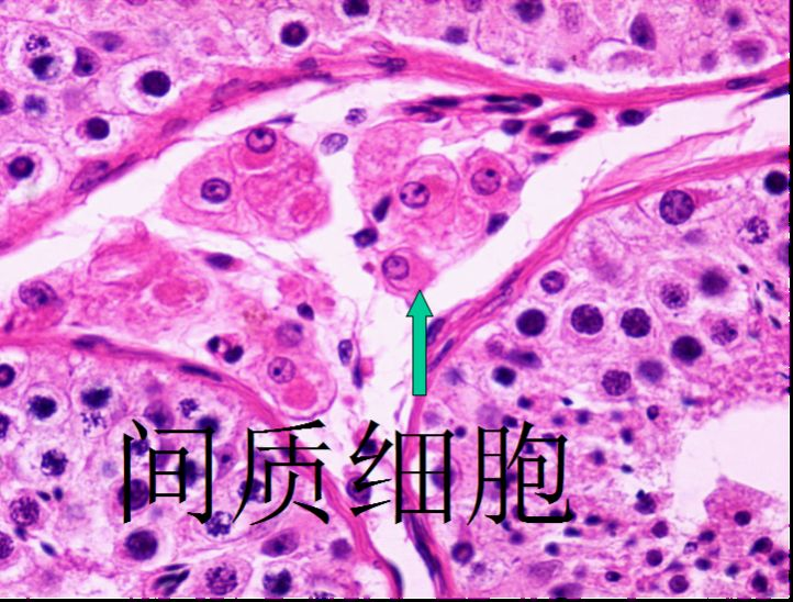 医学病理图像细胞间质与间质细胞的区别