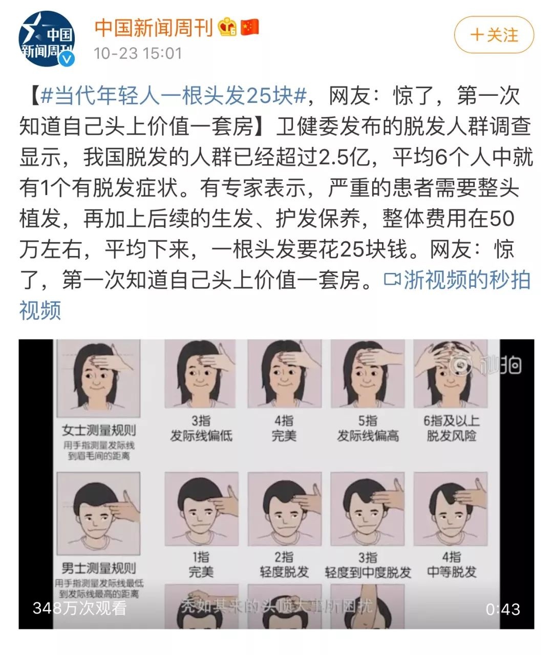 一根头发25元!年轻人,你头上顶着一套房啊