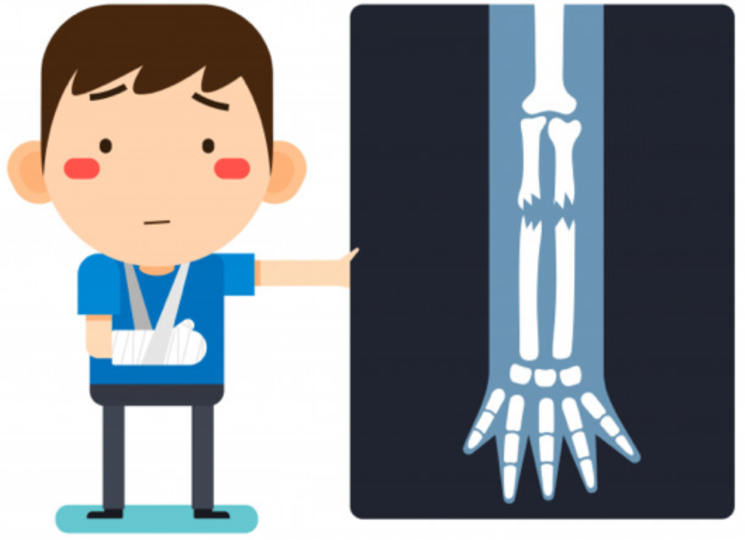 67"免疫杀手" deep x-ray_腾讯技术工程的博客-csdn博客