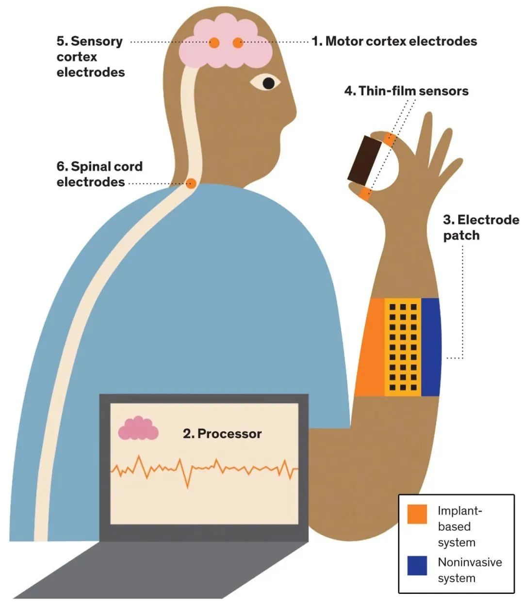 asia pietrzykthe wearable bypassparalyzed people with some motor