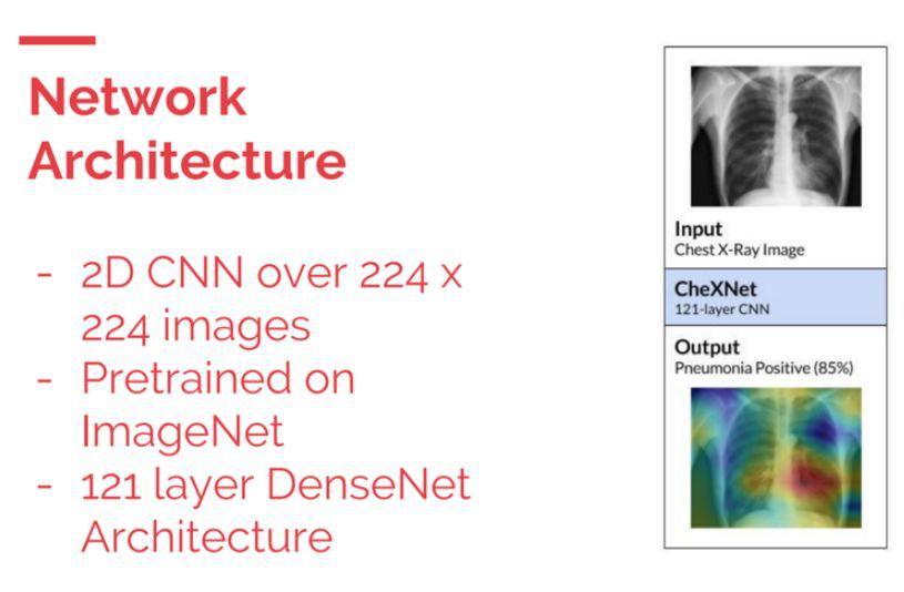 「肺炎 X 光病灶识别」挑战赛：几行代码，就能让医疗检测准确率 20% 的提高！
