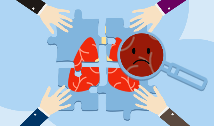 「肺炎 X 光病灶识别」挑战赛：几行代码，就能让医疗检测准确率 20% 的提高！